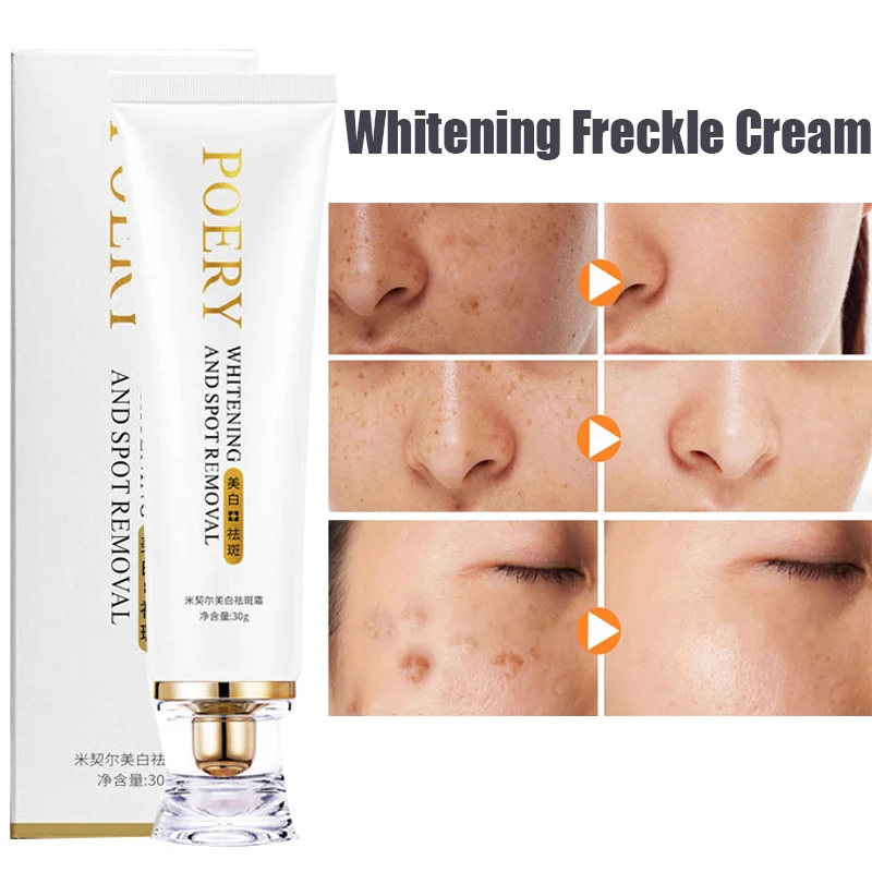 

Freckle Whitening Cream Facial Moisturizer Remove Dark Spots Melanin Melasma Brighten Skin Effective Repair Anti-aging Skin Care