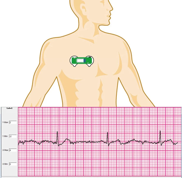 BMD101 ECG комплект для разработки электроники bioобратная связь датчик сердечного ритма HRV Wearables