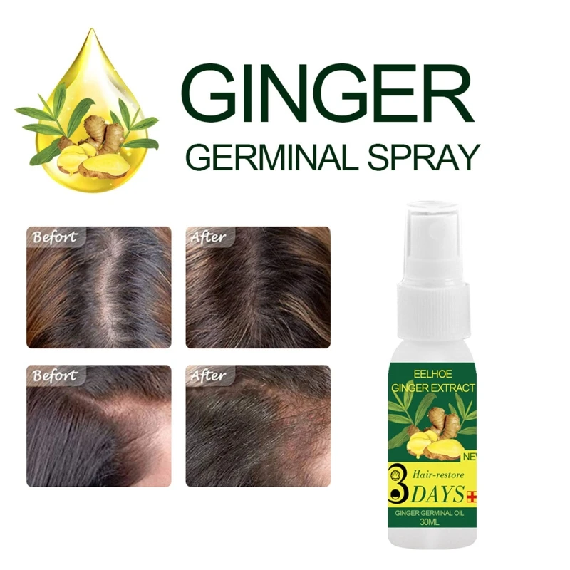 

Q1QD Hair Oil Conditioner Nourish Oil control Hair Growth Serum