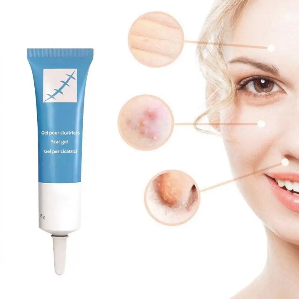 

Scar Removal Cream Acne Scars Gel Stretch Marks Surgical Scar Removal Cream Body Pigmentation Corrector Whitening Skin Care