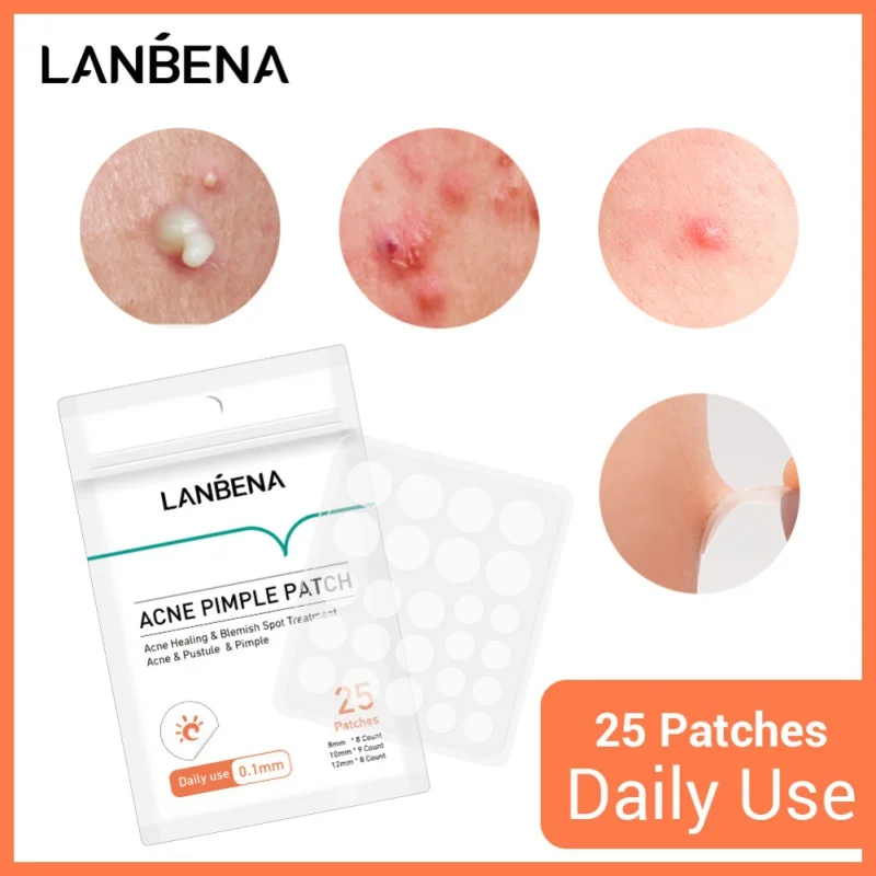 Anti Acne Stickers Blackhead Pimple Remover Facial Tool Face Care Product Removal Patch Treatment Mask