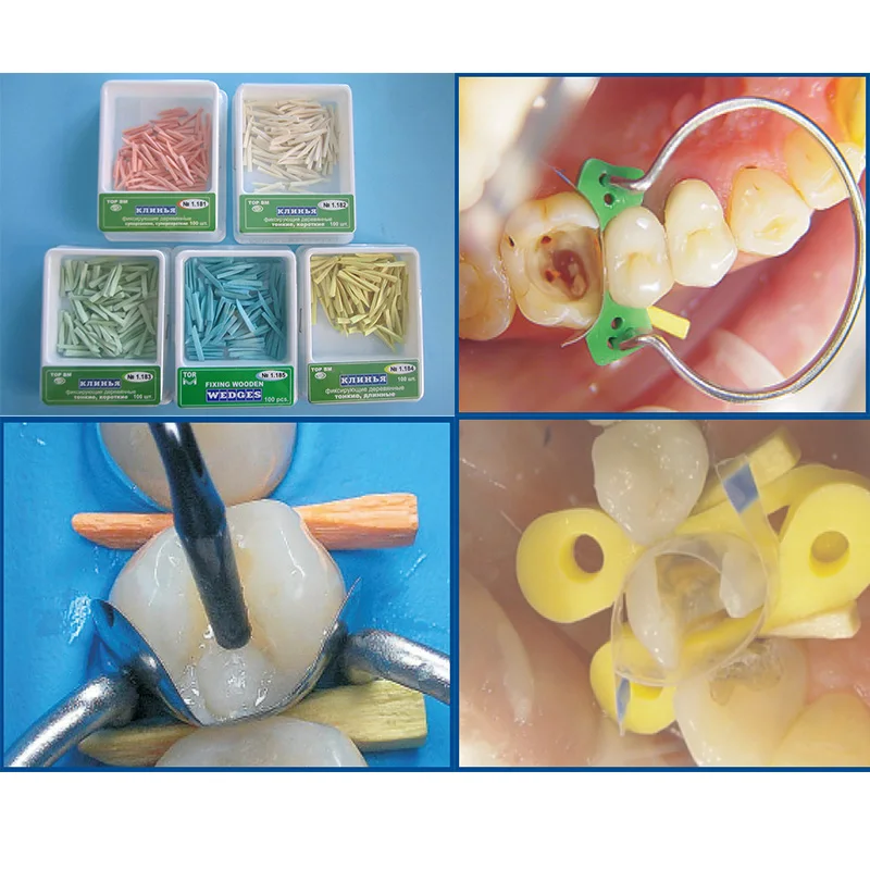 Верхние стоматологические деревянные клинья BM 400 шт./кор. интерстоматологические