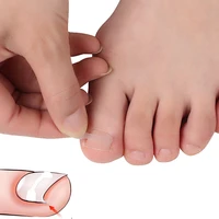toenail ortho nail ingrown nail foot care correction sticker light orthotic portable heavy pedicure tools toenail patch sticker