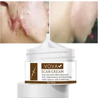 Крем для удаления шрамов от акне VOVA, 100% натуральный крем для восстановления кожи