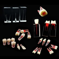 dental education model root pulp cavity modelroot canal model dental supplies