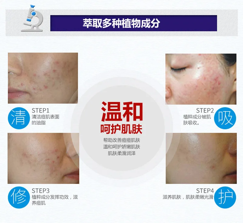 Крем для удаления черных точек на коже 2 шт.|Дневные крема и увлажнители| |