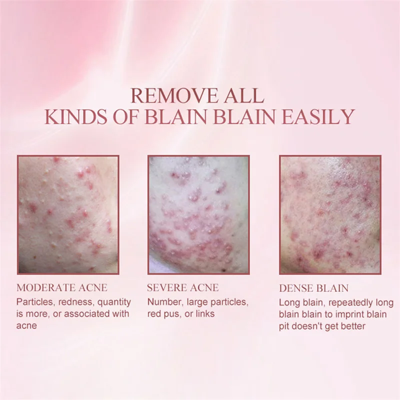 Крем-гель для ухода за кожей лица 15 г | Красота и здоровье