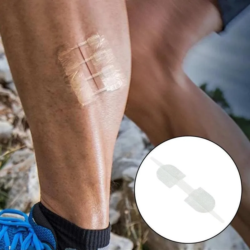 3 шт./компл. пластырь на молнии для улицы маленькая рана быстрый шов