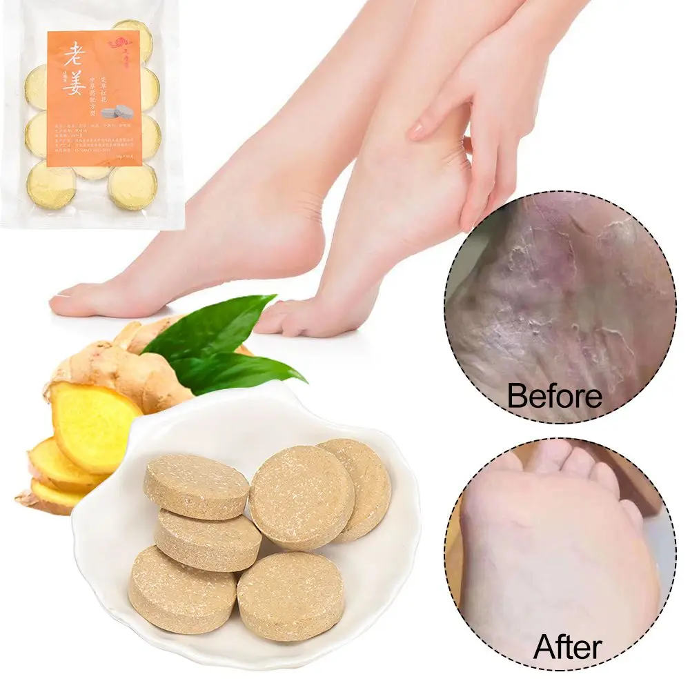 

10PCS/Bag Effective Psoriasis Beriberi Health Care Foot Cracking Peeling Anti-Fungal Foot Soak Nail Treatment