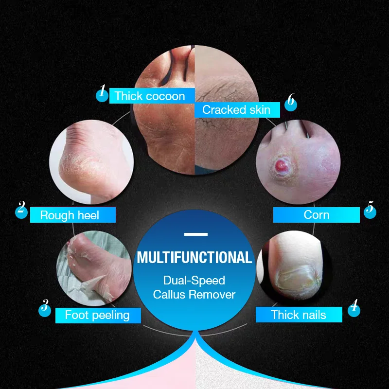 

Electric Vacuum Adsorpt Foot Grinder Electric Foot File Vacuum Callus Remover Rechargeable Foot Files Clean Tools