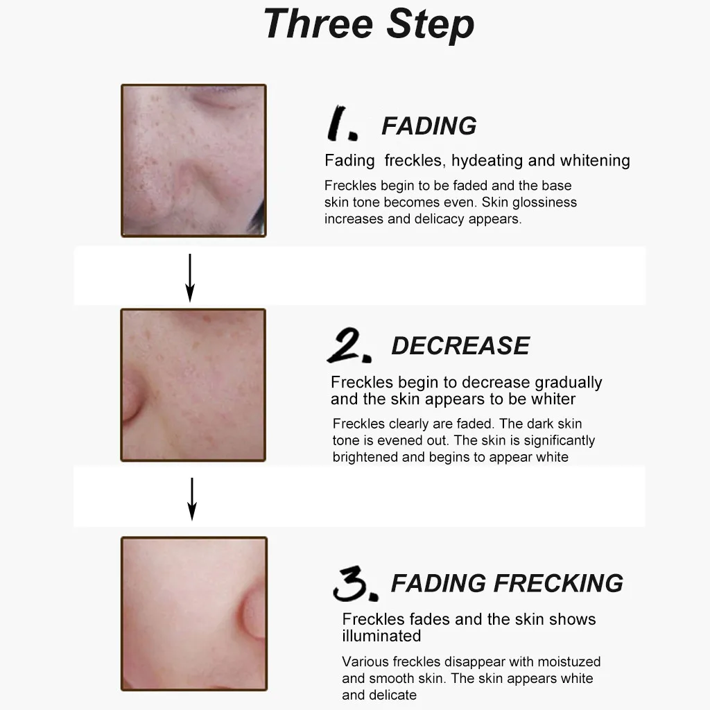 

HAICAR Personal Skin Care Freckle whitening cream moisturizing Freckle Cream For Face Spots whitening Results remove dead skin