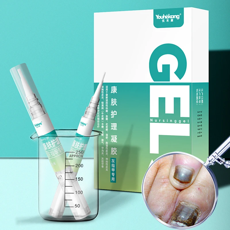 Youhekang онихомикоз лечение грибковых ногтей Уход за ногами Сыворотка для удаления