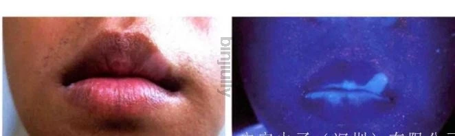 Оборудование для ухода за кожей лица УФ-лампа увеличивающий анализатор салонная