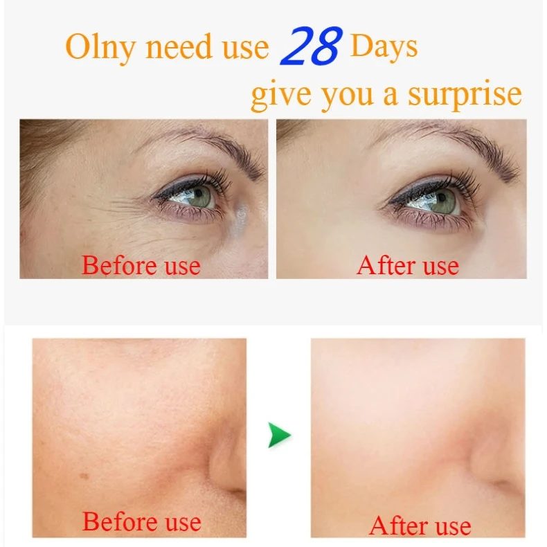 CHUMOLEE шесть пептидов крем для лица против морщин и старения сухой кожи