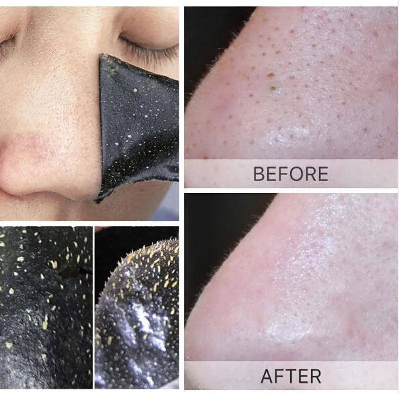 Маска полоска для глубокого очищения пор и удаления черных точек 10 шт.| |