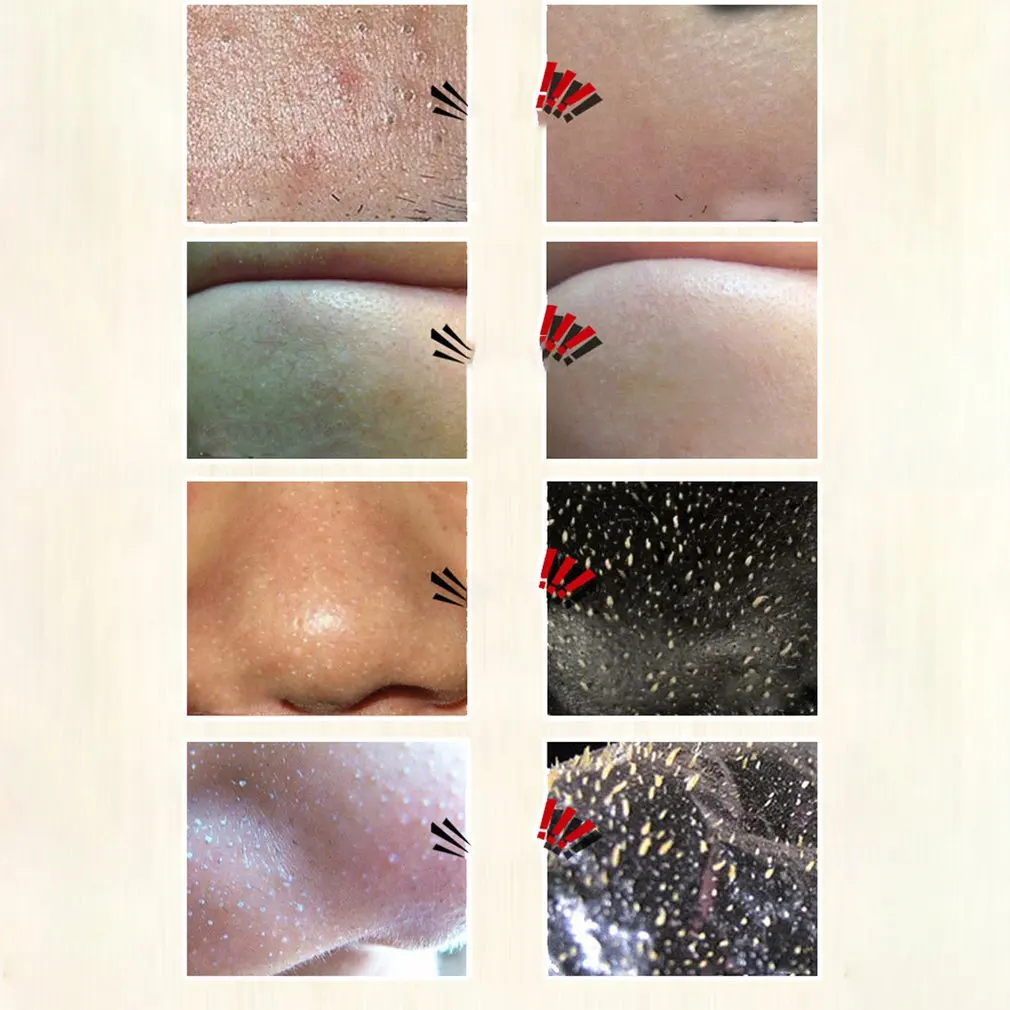 

Bamboo Charcoal Blackhead Peeling Mask Suck Blackheads Remove Acne Clean The Skin Facial Skin Care Mask