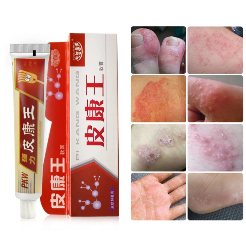 Бактериостатическая мазь для лечения болезней кожи снижает зуд меньше зуда уход