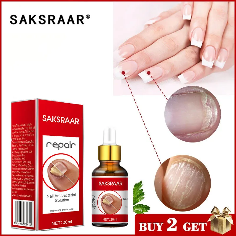 Средство для лечения грибков ногтей эссенция ухода за ногами отбеливание на