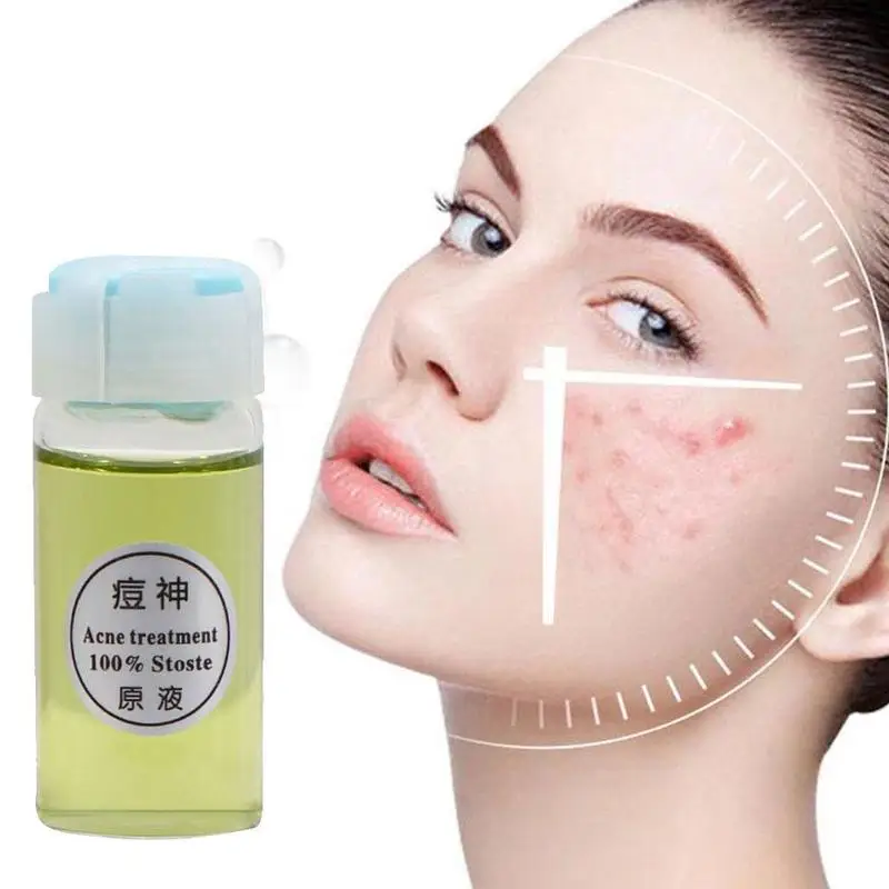 

Acne Treatment Face Serum Oil Control Shrink Pore Scar Essence Whitening Moisturizing Meiyanqiong Skin Care