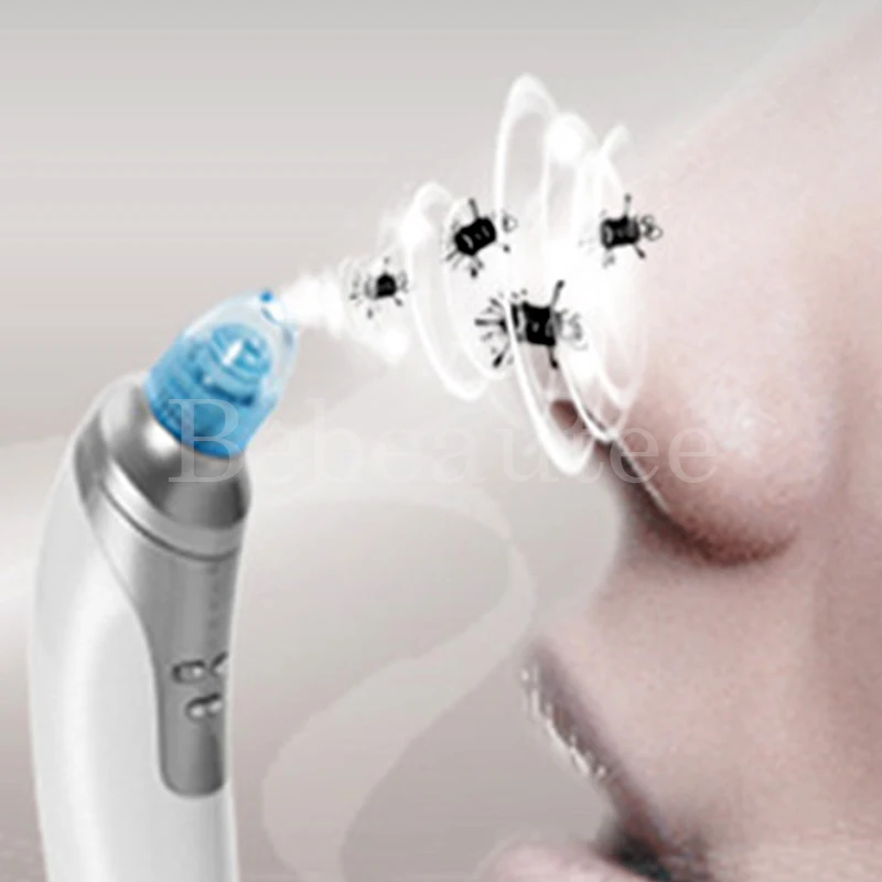 Присоска для выдавливания прыщей и черных точек от акне Вакуумная чистка лица