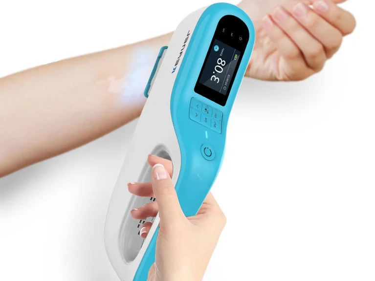 

High power 308nm excimer laser instrument for vitiligo phototherapy