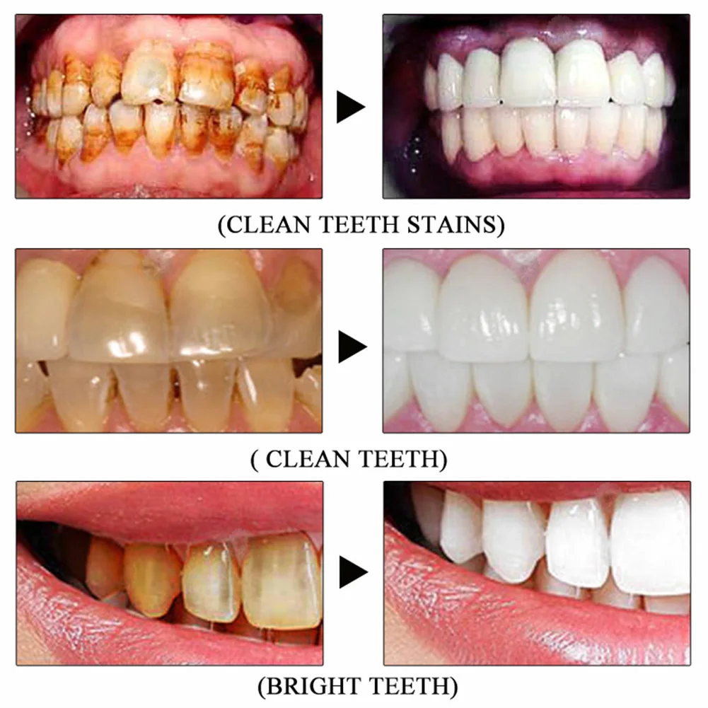 

Tooth whitening tooth powder 50g, remove smoke stains, coffee stains, tea stains, freshen bad breath, oral hygiene, dental care