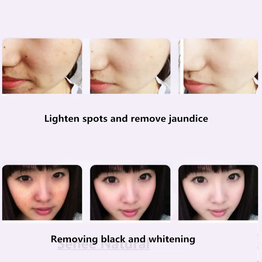 Рисунок 3 - Арбутин крем от веснушек стерилизации