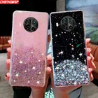 Блестящий чехол Bling Star для Xiaomi POCO X3 NFC Redmi Note 9S 9 8T 8 7 Pro Note9 9A 9AT 9C 8A 7A Mi 10T Lite, мягкий силиконовый чехол