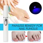 Противогрибковая лазерная указка для онихомикоза ногтей, безболезненный уход за грибком пальцев ног набор жидкостей, Лечение ногтей TSLM1
