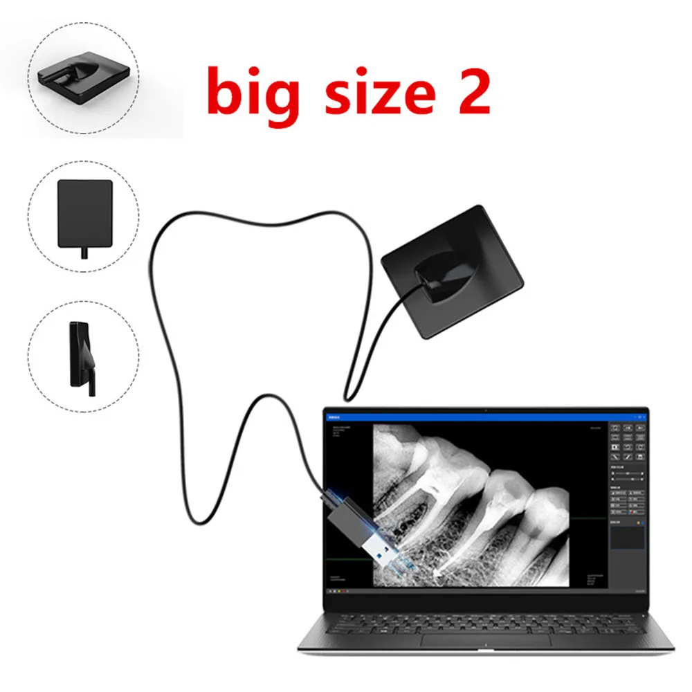

Цифровой интраоральный рентгеновский датчик, стоматологическая рентгеновская система изображения, соединительный кабель USB 2,0, рабочая ст...