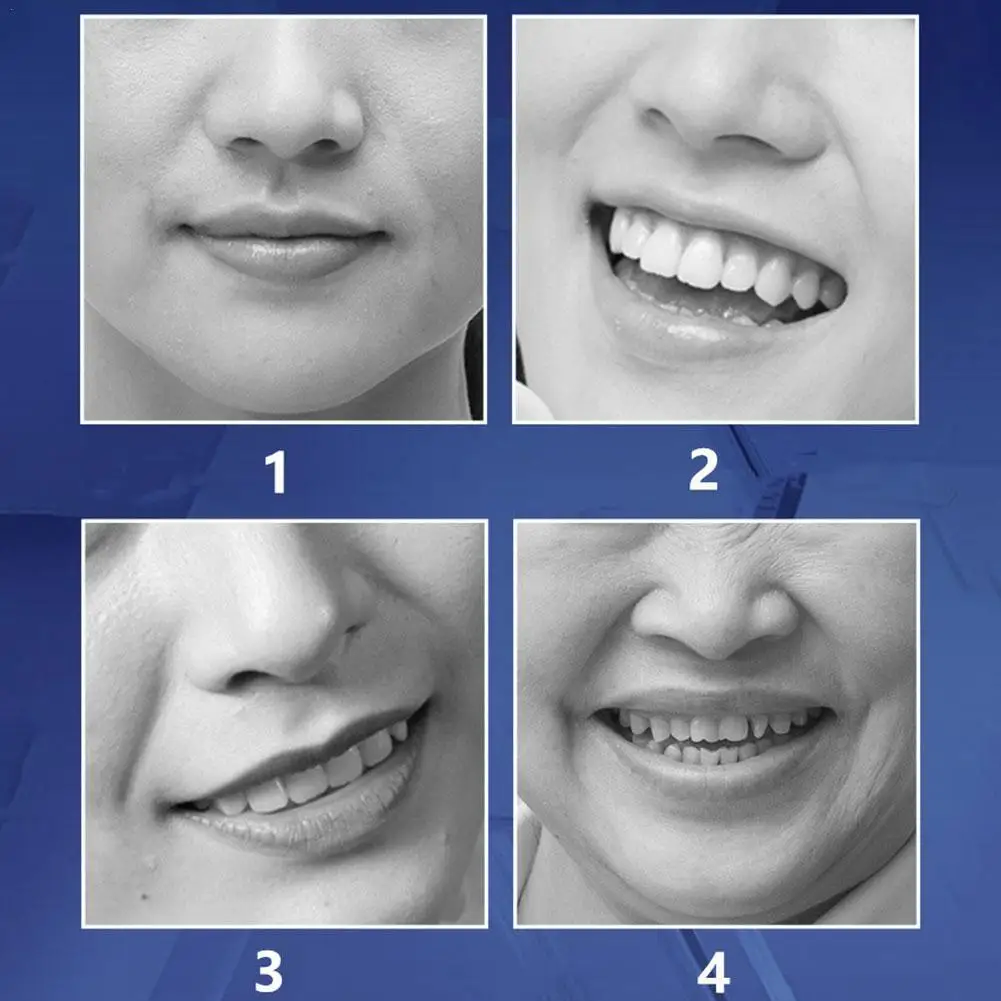 

Micro-Needle Nasolabial Folds Anti Patch Hyaluronic Face Acid Anti-Aging Moisturizing Removal Frown Care Lines J5V7