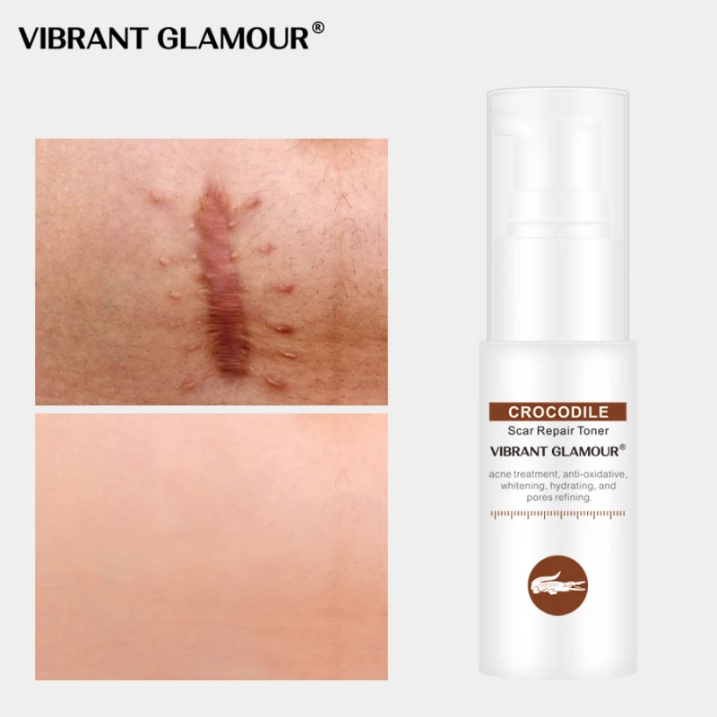 30 мл ярких шик Гиалуроновая кислота уход за кожей лица Отбеливание сокращает