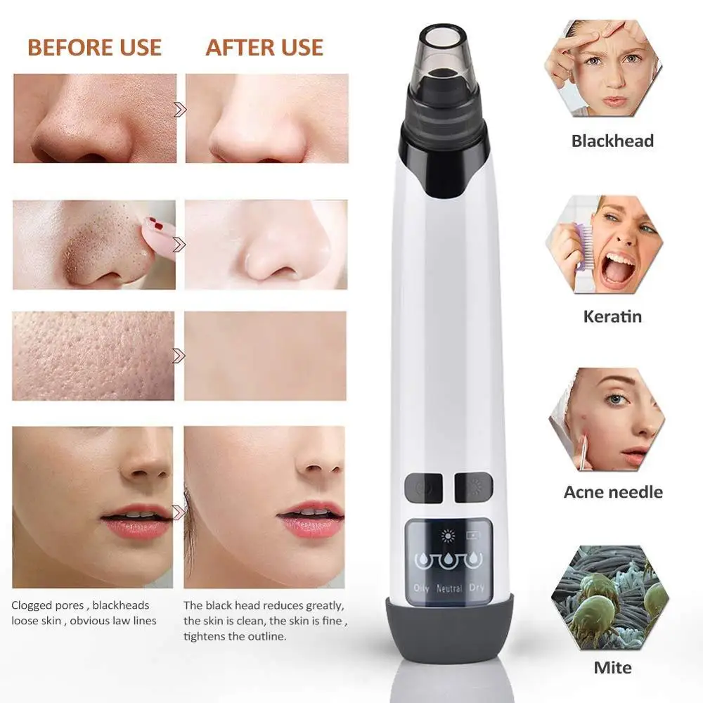 

Blackhead Removal Nose Pore Vacuum Cleaner Rechargeable Blackhead Comedone Acne Suction Electric Tool with Hot Compress
