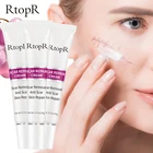 3 шт., Отбеливающий Крем Для Удаления растяжек от акне