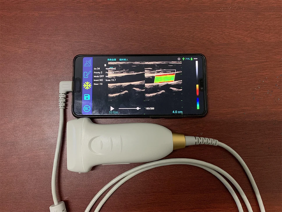 

ultrasonic flaw detector probe New Arrival color Doppler Ultrasound USB Probe Linear Transducer