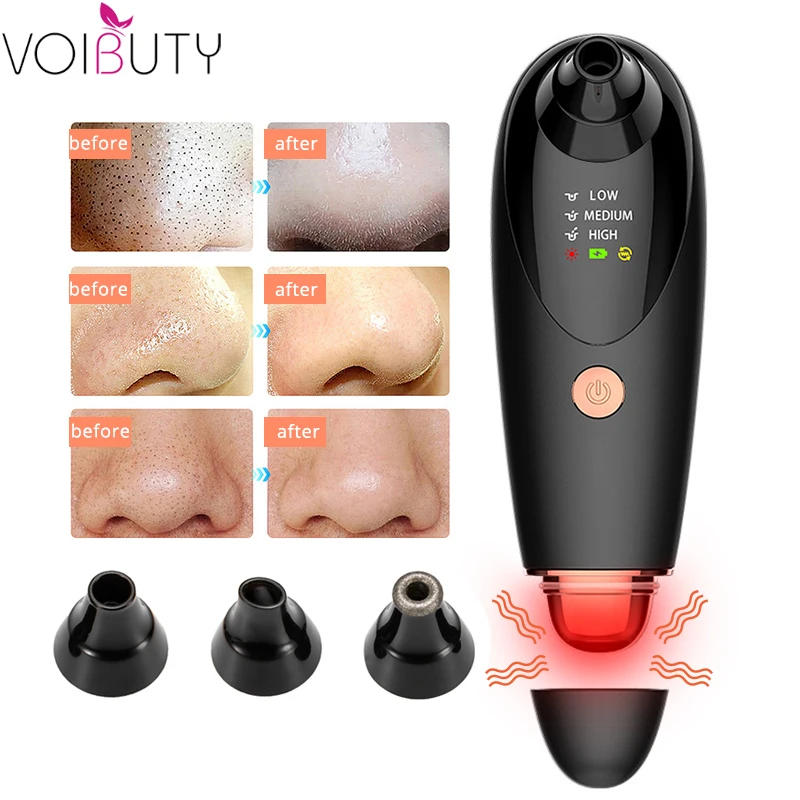 Электрический порог лица вакуумный отсос для угрей удалить машину с 3 зондами