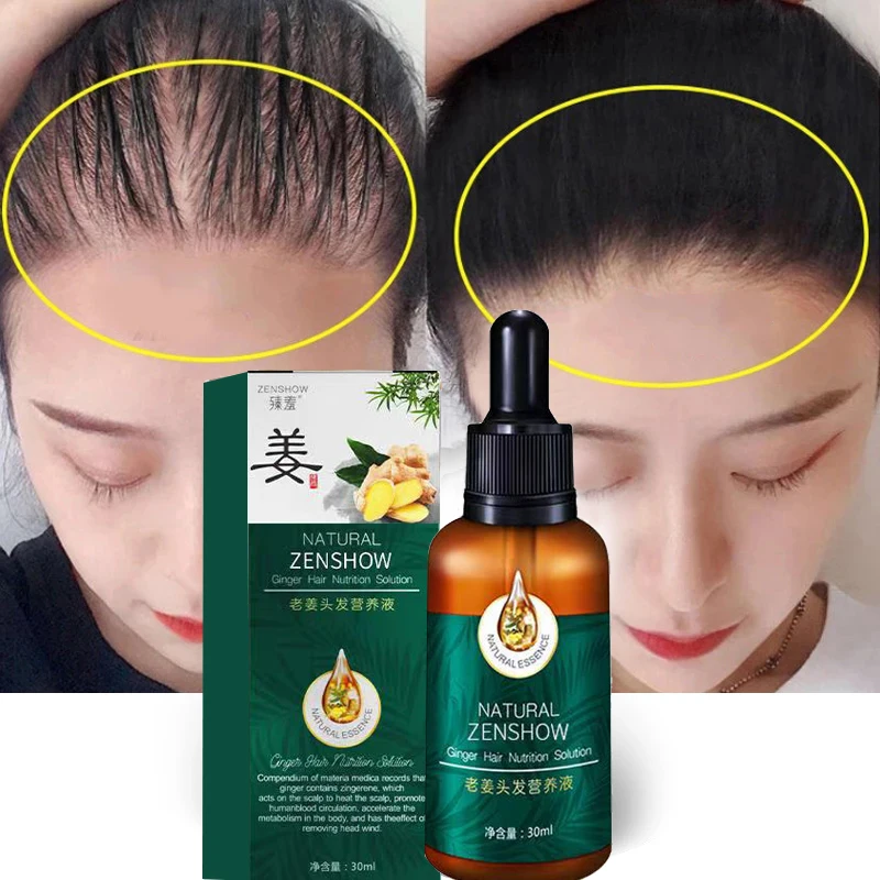 

Ginger Hair Treatment Essential Oil Essence Original Genuine 100% Hair Loss Liquid Health and Beauty Thick Hair Growth Essence