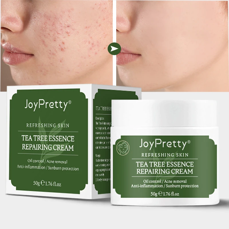 

Effective Tea Tree Oil Acne Treatment Face Cream Oil Control Anti Acne Shrink Pores Whitening Acne Cream Skin Care 50ml