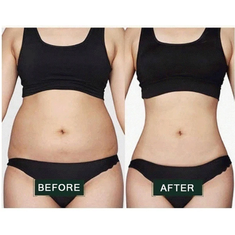 

Body Fat Loss Massage Dissolve Fat Essential Oil Weight Loss Promote Fat Burn Thin Waist Slimming Treatment 10ml Beauty Oil