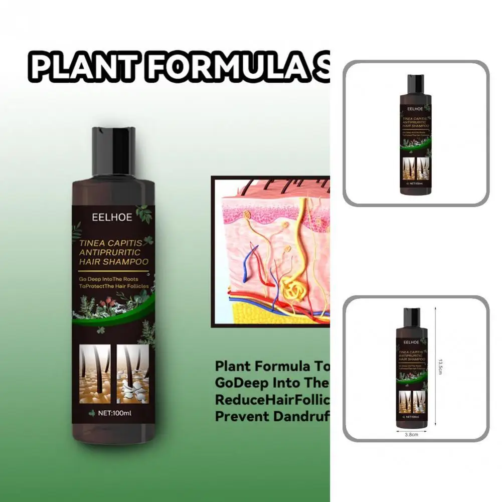 

Non-irritating Universal Anti-dandruff Hair Shampoo Lotion for Home Use