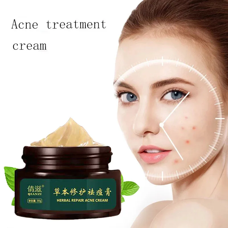 

Herbal Acne Cream Anti Pimple Spot Acne Scars Blackhead Removal Cream Whitening Beauty Skin Face Care Creams Acne Treament