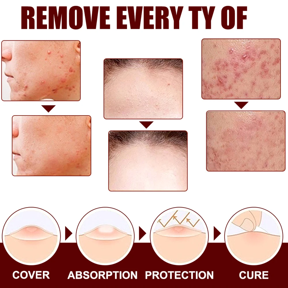 

3 ml Skin Tag Remover Pen Warts Mole Removal Tool Herbal Ingredients Skin Health Care Painless Tasteless
