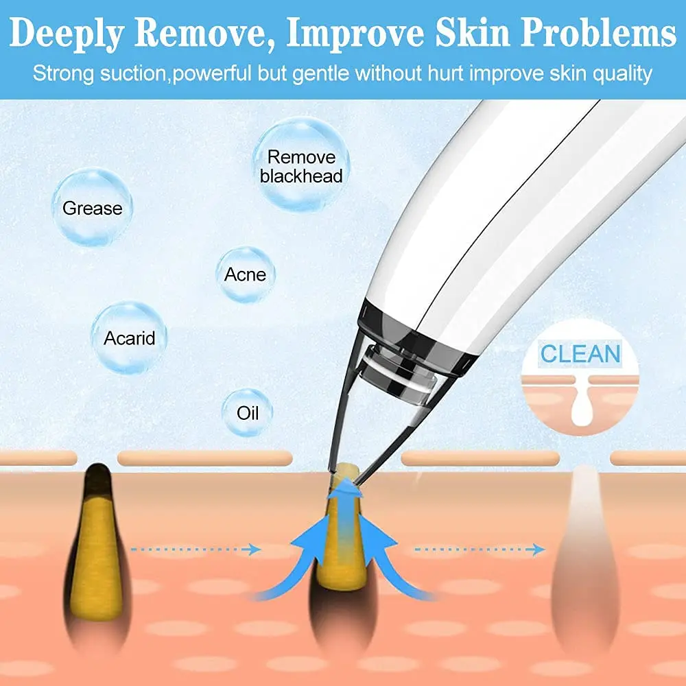 Вакуумное устройство для удаления черных точек на лице инструмент очистки пор и