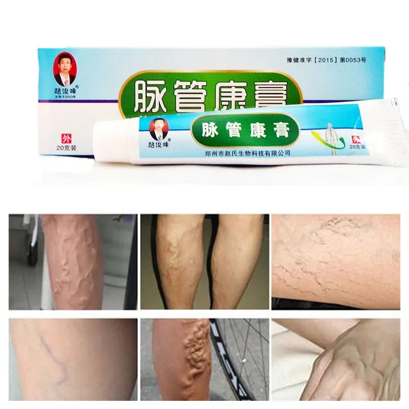 Китайский Пластырь от варикозного расширения вен лечение васкулита мазь для
