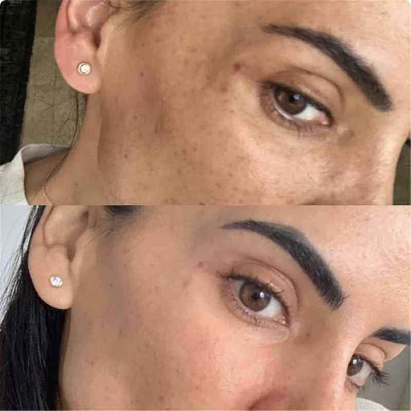 

10/30Whitening Face Serum Remove Dark Circles Fade Freckles Spots Melanin Facial Serum Skin Care