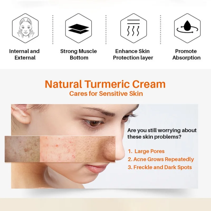 

30ml Herb Turmeric Acnes Treatment Facial Cream Repair Scar Dark Spot Moisturizer Lightening Against Face Skin Care