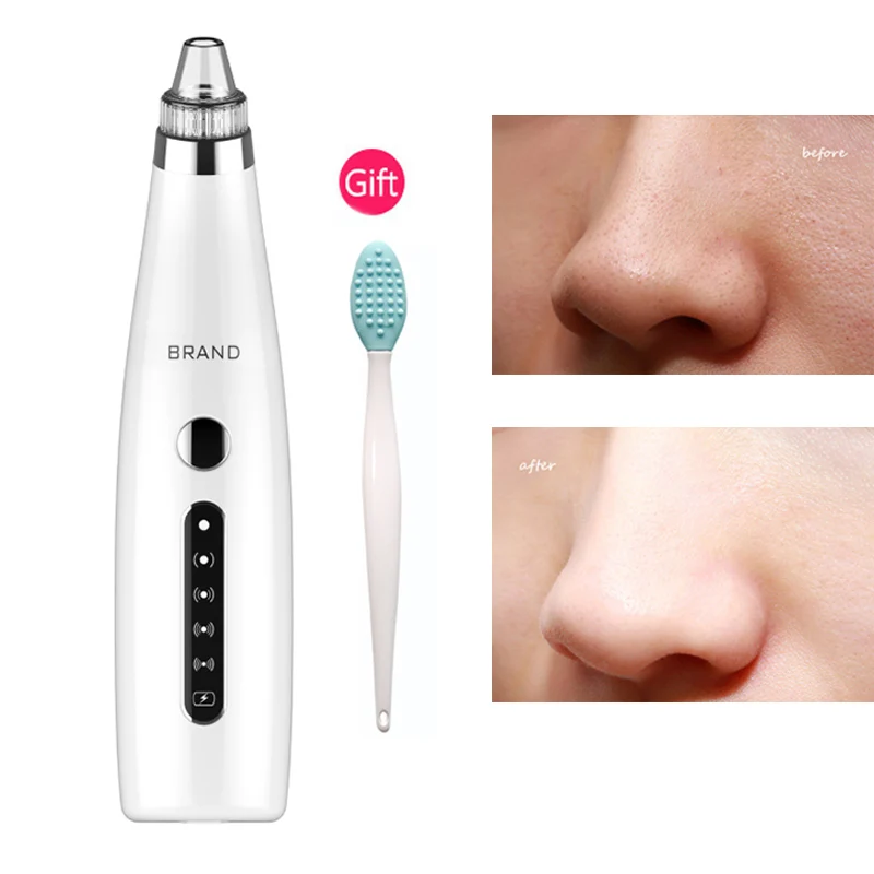 Электрический Пылесос 6 дюймов прибор для очистки лица удаление черных точек