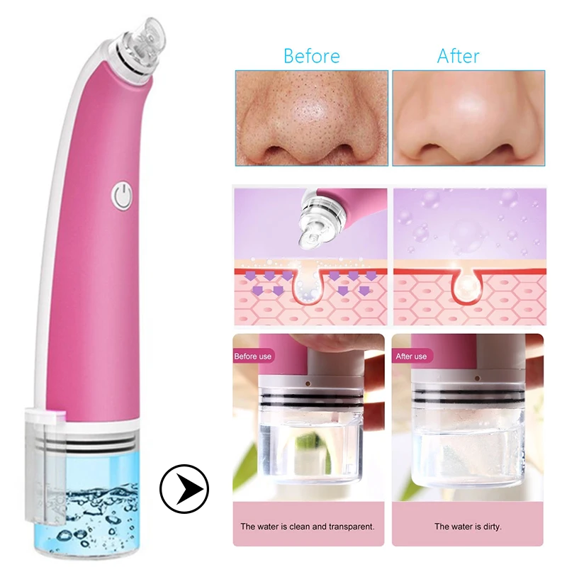 

Multifunctional Suction Blackhead Water Removal Circulation Vacuum Facial Cleansing Machine Portable Deep Cleaning Beauty Device