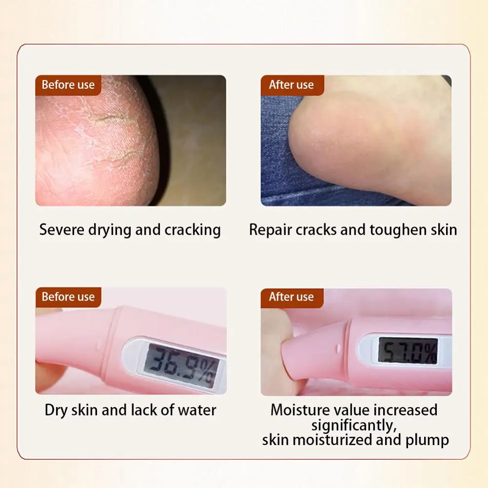 Под змеиную кожу масло для нежных рук Крем-уход антибактериальная защита от