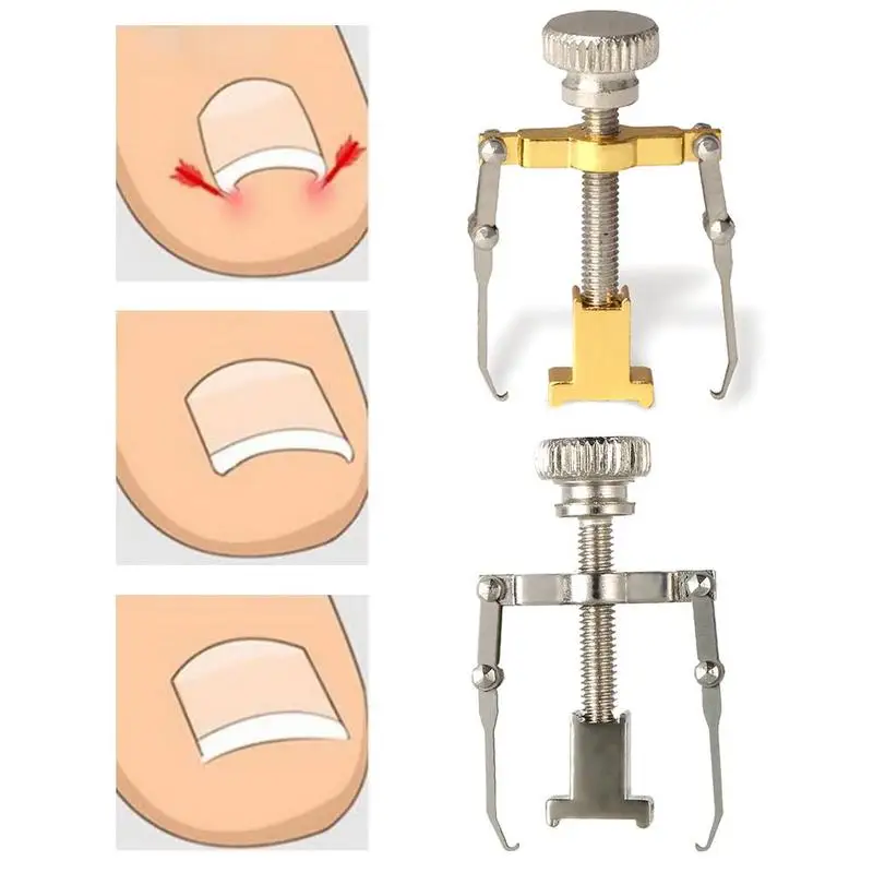 Новые металлические ортопедические принадлежности средство для восстановления